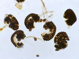 花粉症患者増加の原因といわれている寄生虫の減少